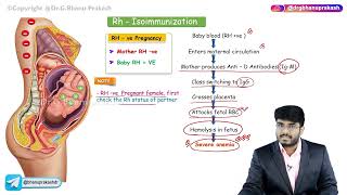 Rh Isoimmunization  Obstetrics and gynaecology lectures [upl. by Keg]