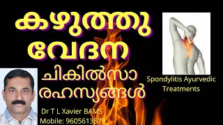 Spondylitis  Neck pain  Greevagraham  Treatment Secretes  Dr T L Xavier  Ayurvedic Medicine [upl. by Araid189]