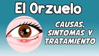 EL ORZUELO Causas síntomas diagnóstico y tratamiento [upl. by Ailel]