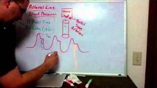 Haemodynamics Part 6 Arterial Line [upl. by Merfe498]