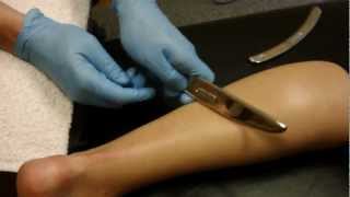 Graston Technique Treatment for Achilles Tendon Injury  Dr Jon Wilhelm Sports Chiropractor [upl. by Annohsed]