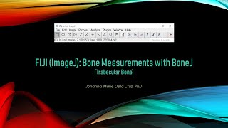 FIJI ImageJ Bone Analysis with BoneJ2 Trabecular Bone [upl. by Zeni]