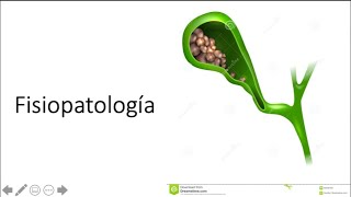 Fisiopatología de colelitiasis [upl. by Harvison53]