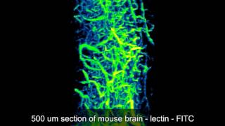 Visikol HISTO  Brain Vasculature [upl. by Khoury631]