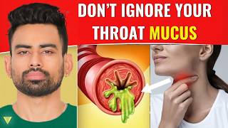 How to Clear Excess Throat Mucus [upl. by Itsrik]