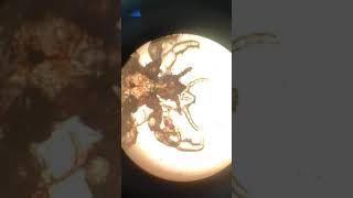 Head lice under microscope [upl. by Nwahsav]