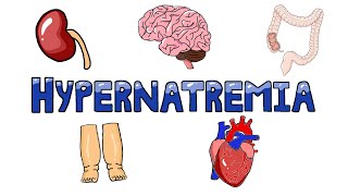 An Approach to Hypernatremia  Hypernatremia Diagnostic Algorithm  Hypernatremia Causes MADE EASY [upl. by Atsirak]