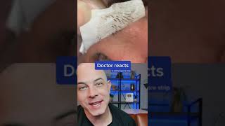 Derm reacts to incredibly satisfying pore strip removal dermreacts porestrip blackheads [upl. by Zsuedat914]