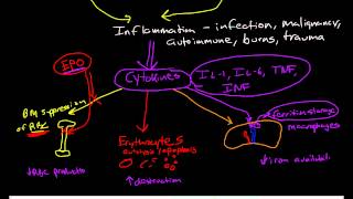 Anemia Pathophysiology 3 Anemia of Inflammation Anemia of Chronic Disease [upl. by Dyna]