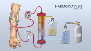 HAEMODIALYSIS DIALYZER [upl. by Akemaj72]