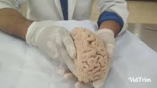 Internal capsule of Brain  Neuroanatomy [upl. by Laohcin99]