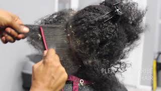 Picking BIG scalp flakes Psoriasis and Dermatitis SEW IN WEAVE REMOVAL [upl. by Rofotsirk593]