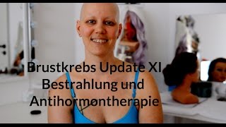 Brustkrebs Update XI  Bestrahlung und Antihormontherapie [upl. by Haleeuqa]