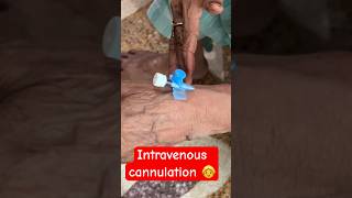 Intravenous cannulation  ivtherapy ivcannulation trending shorts SMpharmacy plz subscribe [upl. by Teria]