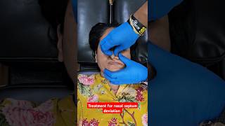 Chiropractic treatment for nasal septum deviation drrajneeshkant worldfamouschiropractor [upl. by Hachman511]