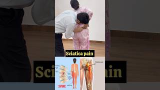 Sciatica pain treatment relief shortfeed trend feed [upl. by Cutlerr15]