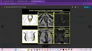 RADIOLOGY EXAM CASES [upl. by Acceber]