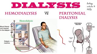 Dialysis  Hemodialysis  Peritoneal dialysis  BIOLOGY ARTICLES AND MCQS [upl. by Einnil]