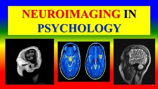 NEUROIMAGING METHOD IN PSYCHOLOGY   Applied psychology for Nursing [upl. by Necila]