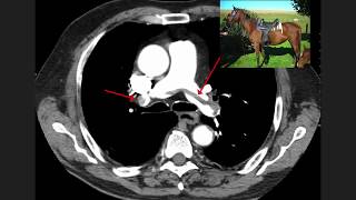 High Yield CT Scans Part 1  USMLE [upl. by Jacobah]