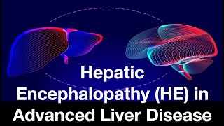 Hepatic Encephalopathy HE in Advanced Liver Disease [upl. by Acina]