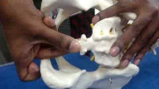 Dr P Senthil Kumar PhD PT Coccyx Mobilization Technique Maitlands Concept for Coccydynia [upl. by Nnaycart]