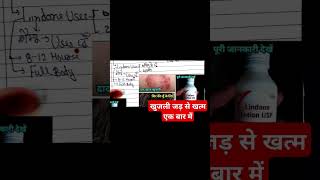 खुजली जड़ से खत्म बस एक बार इस्तेमाल करें। scabies benzyl benzoate lindane lotion drxbilal000 [upl. by Hescock]