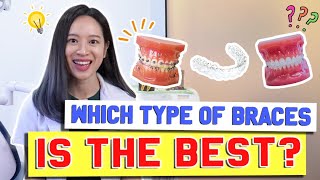 Types of Braces COMPARED amp EXPLAINED  BraceYourself🦷 [upl. by Desireah]