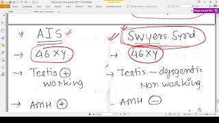 SWYERS SYNDROME  CONCEPT [upl. by Pruter]