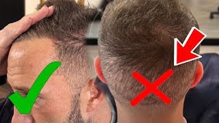 Mike Majlak 8 Months After 2000 Hair Transplant In Turkey  Smile Hair Clinic [upl. by Abihsot]