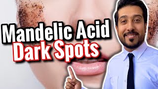 Mandelic Acid for Hyperpigmentation and Dark Spots  How to Use Mandelic Acid CORRECTLY [upl. by Akibma]