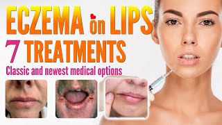 Eczema on Lips Treatment Options  How to Treat Lip Eczema Around Mouth Dermatitis [upl. by Wickner]