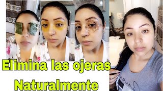 Elimina Ojeras y Bolsas de ojos en pocos días  Trucos de Belleza [upl. by Flora]