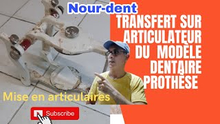 Transfert sur articulateur du modèle dentaire la mise en articulaires prothèse dentaire [upl. by Brader]