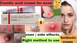 Fusidic acid cream uses in hindi  benefits of fusidic acid cream  fucidin cream review [upl. by Yram201]