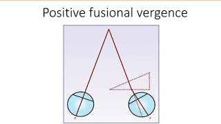 Orthopics series 5  Positive fusional vergence  PFV [upl. by Ramraj]