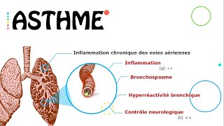 Asthme état stable 😷  Résumé  PneumoPhtisiologie [upl. by Vanya102]