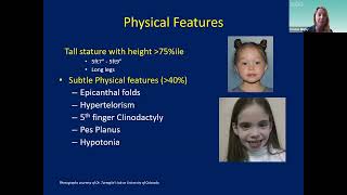 Kristen Wigby MD  Trisomy X A Review and Care Update for Families and Health Care Providers [upl. by Laszlo662]