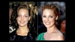 hollywood stars and veneers  before and after [upl. by Ardnaik]