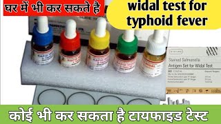 widal test in hindi  widal test  widal test kaise kiya jata hai  typhoid test kaise kiya jata hai [upl. by Walkling]