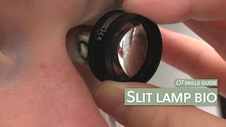 OT skills guide Slit lamp bio [upl. by Ermina]