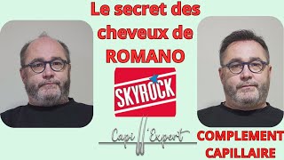 LE SECRET DES CHEVEUX DE ROMANO  Complément Capillaire  prothèse capillaire  calvitie [upl. by Novoj770]