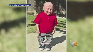 Actor Verne Troyer Dead At 49 [upl. by Sremlahc]