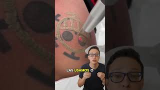 Removendo Tatuagem 😯🖊️ curiosidades curiosidademedicina medicina medico tattoo tatuagem [upl. by Snyder]