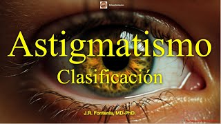 Clasificación del Astigmatismo [upl. by Anairad63]