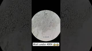 Pimples at 400X magnification are really cool underthemicroscope beefcut scienceshorts [upl. by Smeaj857]