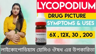 Lycopodium Homeopathic Medicine Bangla  লাইকোপোডিয়াম [upl. by Isaac350]