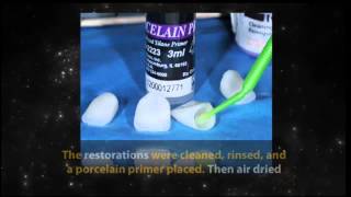 How to Simplify Adhesive Cementation with DUOLINK UNIVERSAL™ [upl. by Almap]