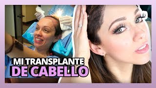 MI TRANSPLANTE DE CABELLO  HAIR TRANSPLANT SURGERY  RosyStoryTime [upl. by Atauqal]