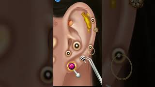 Asmr ear wax removal asmr asmrvideo shorts earringsanimation [upl. by Lleret541]